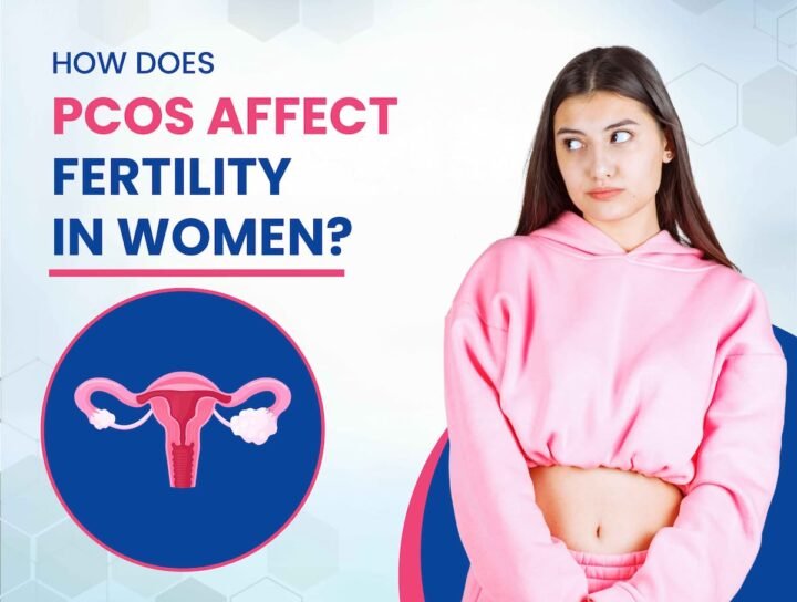 How Does PCOS Affect Fertility in Women