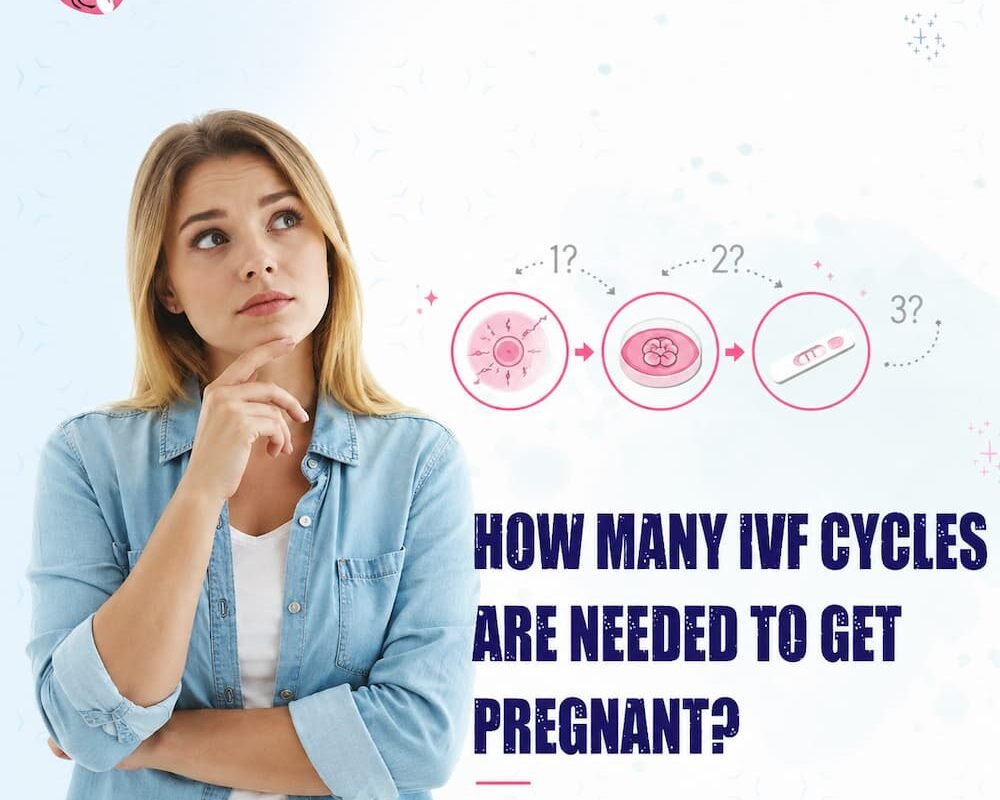 How Many IVF Cycles Are Needed to Get Pregnant